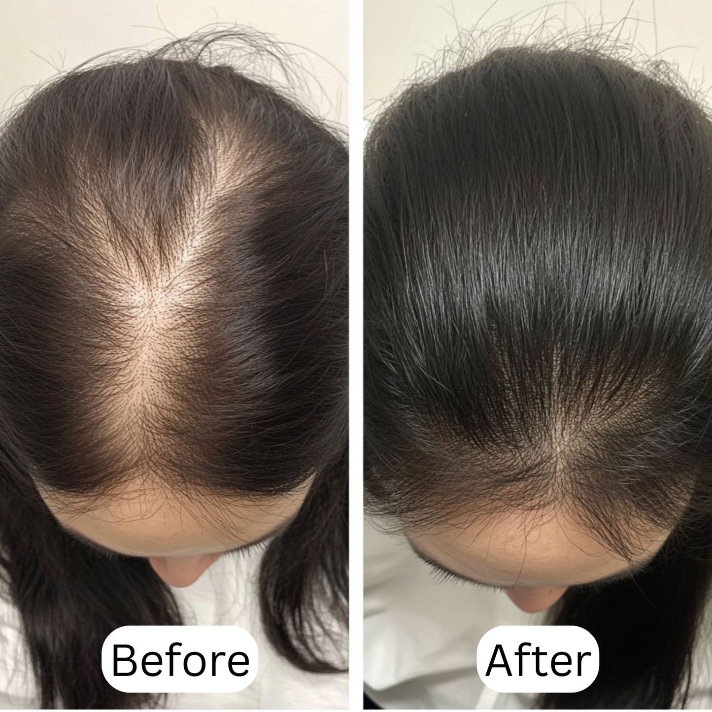 Hair Growth Daily Wash Duo